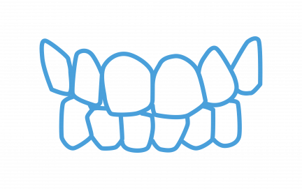 Crooked Teeth Crooked Teeth