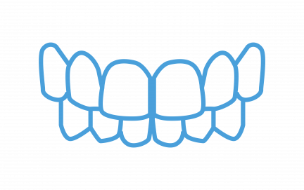 Overbite Overbite