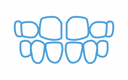 Spacing or Gaps Spacing or Gaps